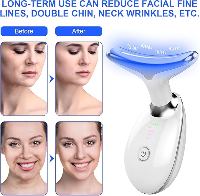 [Ultra-Premium Original] SLIMQUEEN Facelifting Wrinkle Remover (LED Proton Therapy, Face Slimming, Lymphatic Drainage, Electric Muscle Stimulation)